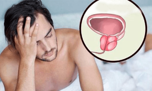 Síntomas da prostatite