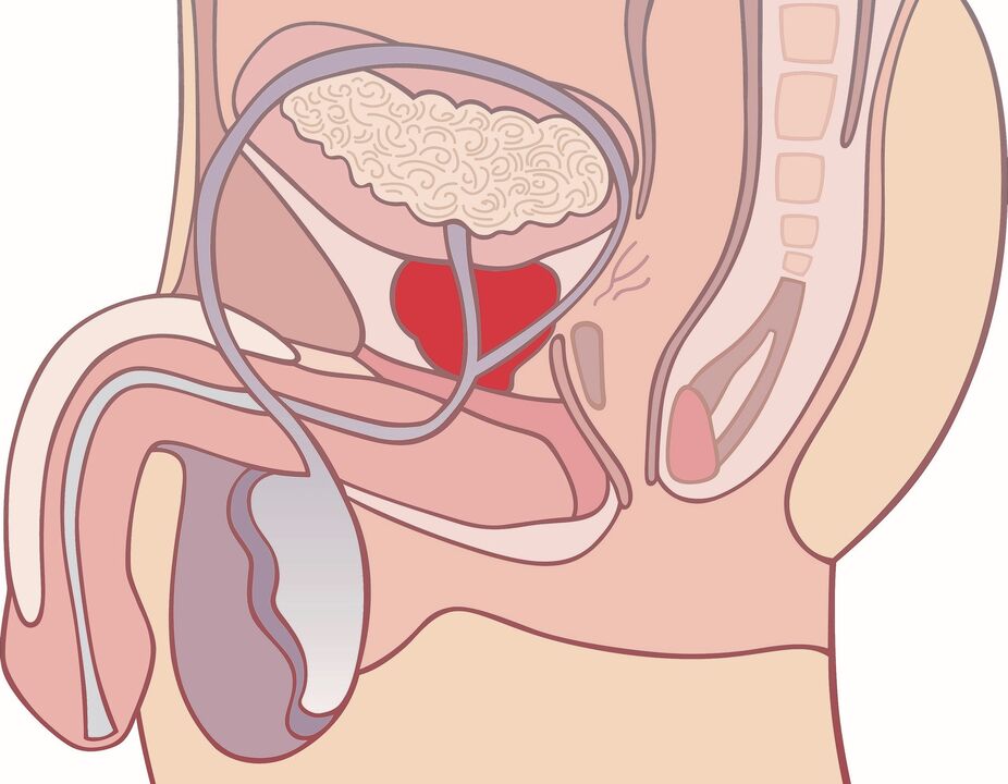 próstata inflamada con prostatite